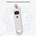 thumbnail image 4 of Ganfancp Succionador de Puntos Negros Limpieza de Poros Lavado Equipo de Belleza Recargable Ofertas Del Día 1X Medidor de Puntos Negros, 4 of 7