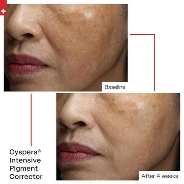 cyspera Intensive Pigment Corrector, the Original Formula