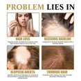 thumbnail image 3 of West & Month Dense Hair Ball Scalp Massage Care Moisturizing Hair Root Thick Soft Hair Care Ball, 3 of 4