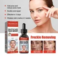 thumbnail image 2 of Suero Facial de niacinamida, ácido salicílico, productos hidratantes para el cuidado de la piel, 2024, 2 of 5