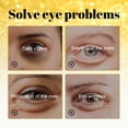 thumbnail image 3 of 2pcs 24K Gold Anti-Wrinkle Eye Mask, Moisturizing And Improving Eye Lines Brightening And Moisturizing Eye Skin Eye Care, 3 of 5