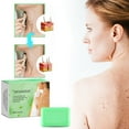 kemilove Smooth Skin Wart Eliminator Soap Natural Soap Instant Removal 100g Lay down Tanning Bed