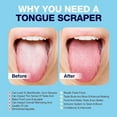 thumbnail image 3 of Tongue Coating Cleaner - Suitable For Adults And Children, Promotes Healthy Oral Care, Easy To Use, Fights Bad Breath, 3 of 5
