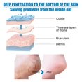 thumbnail image 4 of 1 par de botines exfoliantes para callos, mascarilla suave para pies, paquete de hojas, Spa para pies, cuidado de la piel, 4 of 5