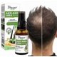 thumbnail image 2 of Herbal Hair Growth Essence Mist, Hair Tonic Mist, Hair Growth Herbal Mist, Anti-hair Loss Mist, Suitable For Men And Women Of All Hair Types, 2 of 4
