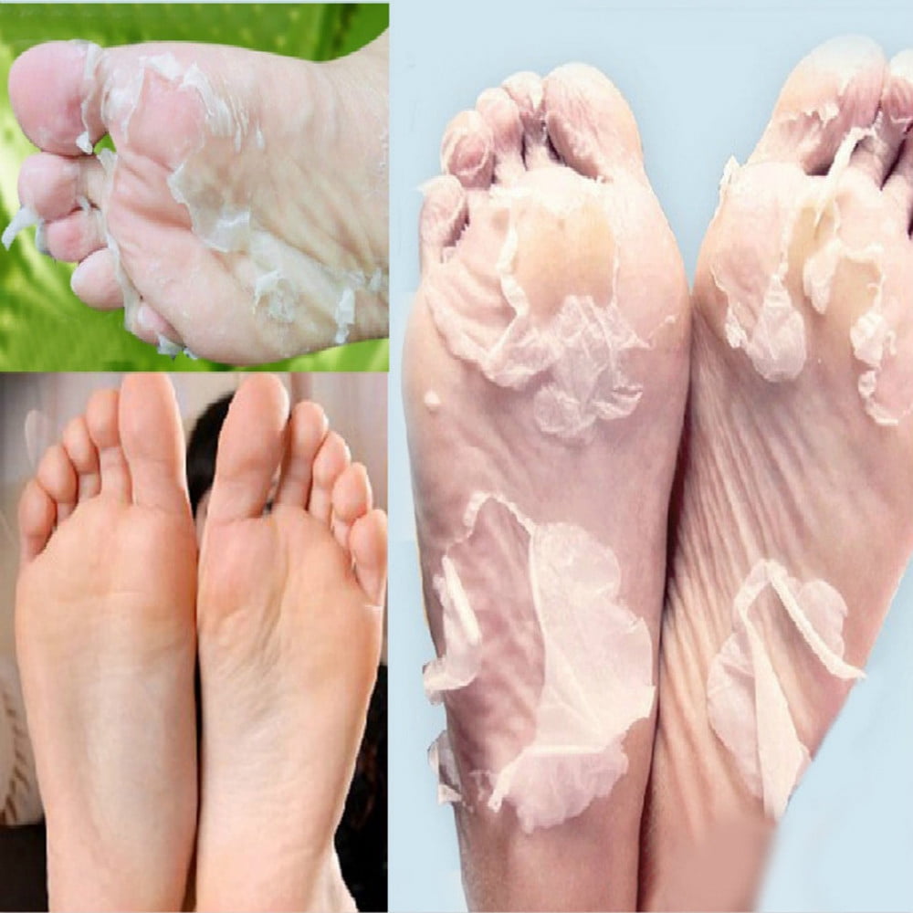 Mnjin Hot Remove Dead Skin Foot Mask Peeling Cuticles Heel Feet Care Anti Aging 5ML White Walmart