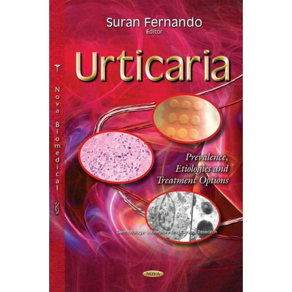 Urticaria : Prevalence, Etiologies and Treatment Options