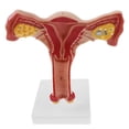 thumbnail image 5 of 1:1 Human Female Uterus Ovary Fallopian Tubes Anatomical Human Anatomy Teaching, 5 of 5