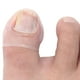 thumbnail image 1 of Corrector de Unas de Pies, Silicona Duradera Prácica Corrector de Unas de los Pies de la Uaña Transparente Transparente, Hogar de Pie Para Unas de los Pies, 1 of 7