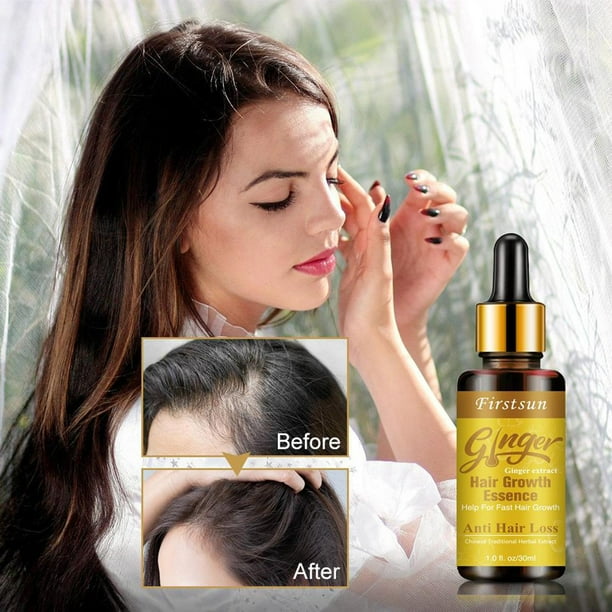 Suero para el crecimiento del cabello, tratamiento para la pérdida y adelgazamiento del cabello, suero para el cabello, estimula el crecimiento de cab Salvador esencia de crecimiento