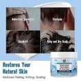 thumbnail image 2 of Seborrheic Dermatitis Cream, Anti Fungal Shampoo, Scalp Treatment for Psoriasis, Folliculitis, Dry Scalp, Anti-Itch, Sooth_c*, 2 of 5