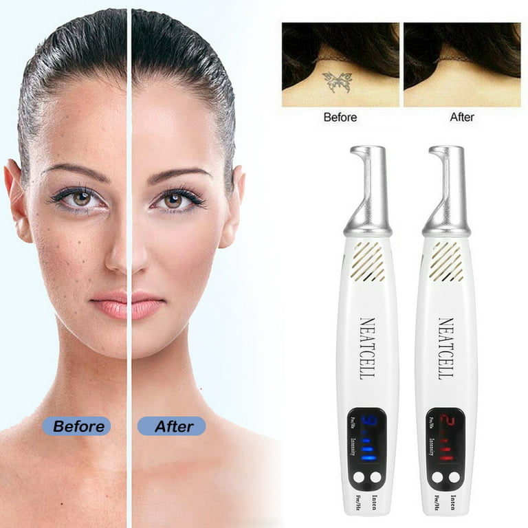 Electric Laser Mole Removal Pen For Laser Skin Care Wart, Corn, Freckle, Tag,  Nevus, Sweep Spot, Tattoo Removal Salon Beauty Machine From Zal_beauty,  $21.07