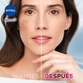 thumbnail image 3 of Kit Facial Completo NIVEA Luminous 630 Anti-manchas Enriquecido con Ácido Hialurónico para Mujer, 3 of 11