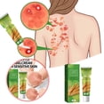 thumbnail image 1 of Facial Skin Care Products Ointment And Red And Itchy Skin, 1 of 8
