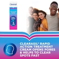 thumbnail image 3 of Crema facial Clearasil Ultra Rapid Action 25 ml, 3 of 6