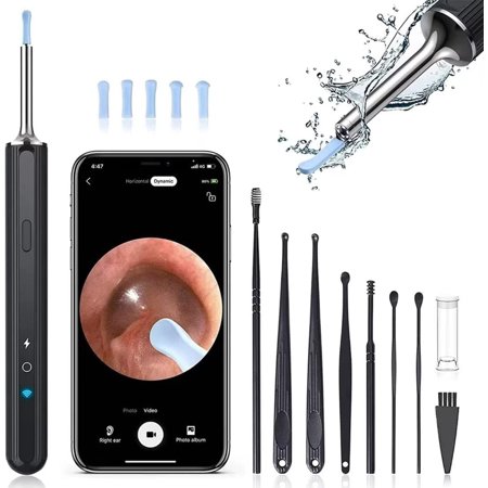 Ear Wax Removal Tool Camera - Birthday Christmas Gifts for Women Men Mom Dad, FSA HSA Eligible, Ear Wax Removal Kit with 7 Ear Pick, Ear Cleaner with 1080P Camera for iOS Android (Black)