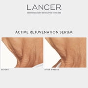 Lancer Active Rejuvenation Triple Dermal Complex Serum, 1 fl oz