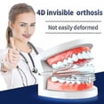 thumbnail image 3 of Mouth Guard,braces Invisible 3 Stages Tooth Appliance Aligners Trays Teeth Straightener Retainer Alignment Trainer Mouth, 3 of 5