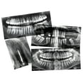 thumbnail image 3 of DENTAL XRAYS, 3 of 5