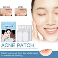 thumbnail image 1 of Acne Pimple Patches Acne Pimple Patches 5 Sizes Acne Patches Waterproof Hydrocolloid Acne Cover Patches For Acne Skin ANGGREK Acne Pimple Patches, 1 of 8
