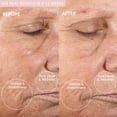 thumbnail image 4 of Máquina de microdermoabrasión PMD Personal Microderm Classic, 4 of 9