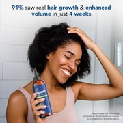 Botanic Hearth Rosemary Hair Oil 4 fl oz | 100% Pure & Natural | With Biotin, Jojoba & Castor Oils | Strengthens, Repairs & Nourishes Hair | Promotes Hair Growth & Healthy Scalp