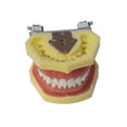 thumbnail image 2 of Techtongda Tooth Teaching Giant Teeth Model Extractions of Education Removable, 2 of 6