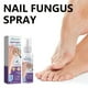 thumbnail image 5 of Desodorante en aerosol para pies frescos y espray para uñas, reduce el mal olor de pies, 100 ml, 5 of 5