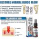thumbnail image 5 of 4pcs Varicose Vein Massage Spray for South Moon - Say Goodbye to Leg Discomfort, 5 of 5