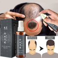 thumbnail image 1 of Suero para el crecimiento rápido del cabello para hombres y mujeres, tónico para el crecimiento del cabello, suero anticaída para la caída del cabello, tratamiento para adelgazar el cabello, 2022, 1 of 3