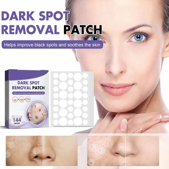 EDHITNR Micropoint Dark Spot Patches, 395 Dissolving Micropoints for Post-Cosmetic Dark Spots, Clinically Tested Non-Irritating Brightening Patches for Face and Skin