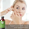 thumbnail image 2 of Tea Tree Essential Oil for Face, Hair, Diffuser, Therapeutic Grade 4 fl oz by Pure Body Naturals, 2 of 6