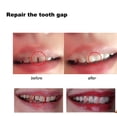 thumbnail image 4 of Pegamento para dientes sólidos, gránulos para reparación de dientes, bricolaje, dientes postizos MABOTO Cola de dientes, 4 of 5
