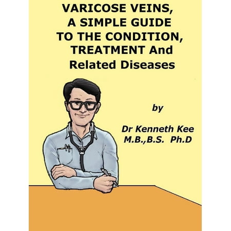 Varicose Veins, A Simple Guide To The Condition, Treatment And Related Diseases -