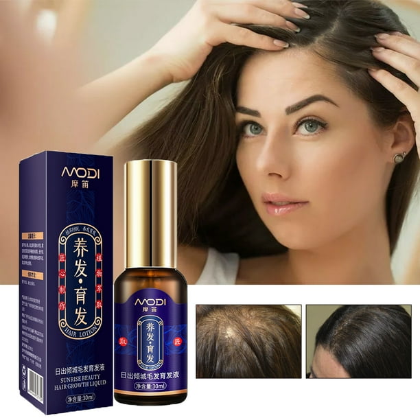 Fiudx Solución Nutritiva Capilar con Extracto de Jengibre Polygonum. Revitaliza La Densidad Capilar, Promueve La Salud Del Cuero Cabelludo y Reduce La Caída Del Cabello. Uso Diario para Hombres y Muj