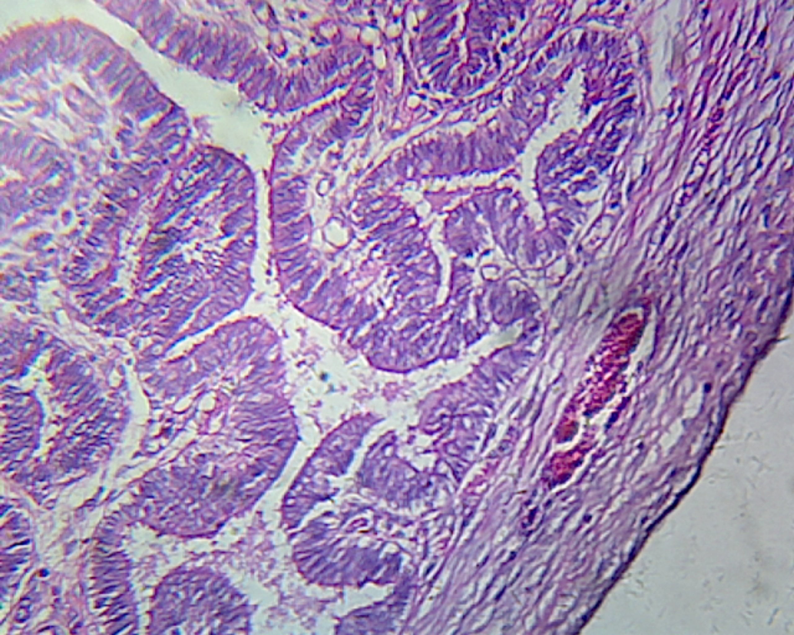 GSC International PS0281 Fallopian Tube Human Showing GSC International PS0281 Fallopian Tube Human Showing