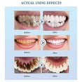thumbnail image 4 of Suero blanqueador dental, gel blanqueador para la higiene bucal, elimina las manchas de placa, limpieza y blanqueamiento dental., 4 of 5