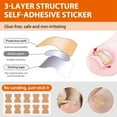 thumbnail image 3 of LNGOOR Ingrown Toenail Tool Set  Corrector Pedicure Tools  152 Pieces Curved Nail Tools  Ingrown Toenail Correction Patch  Toenail File  Lifter  for Ingrown Toenails, 3 of 8