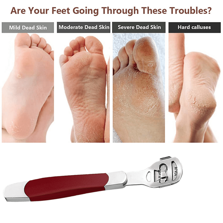 Stainless Steel Foot Callus Remover, Foot Care Pedicure Callus