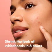 Hero Cosmetics Mighty Patch Absorb and Brighten - Original and Micropoint for Dark Spots, 20 Count