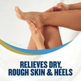 thumbnail image 4 of 2 Pack - Gold Bond Foot Cream Therapeutic 4 oz Each, 4 of 5