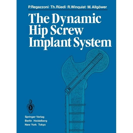 The Dynamic Hip Screw Implant System (Paperback)