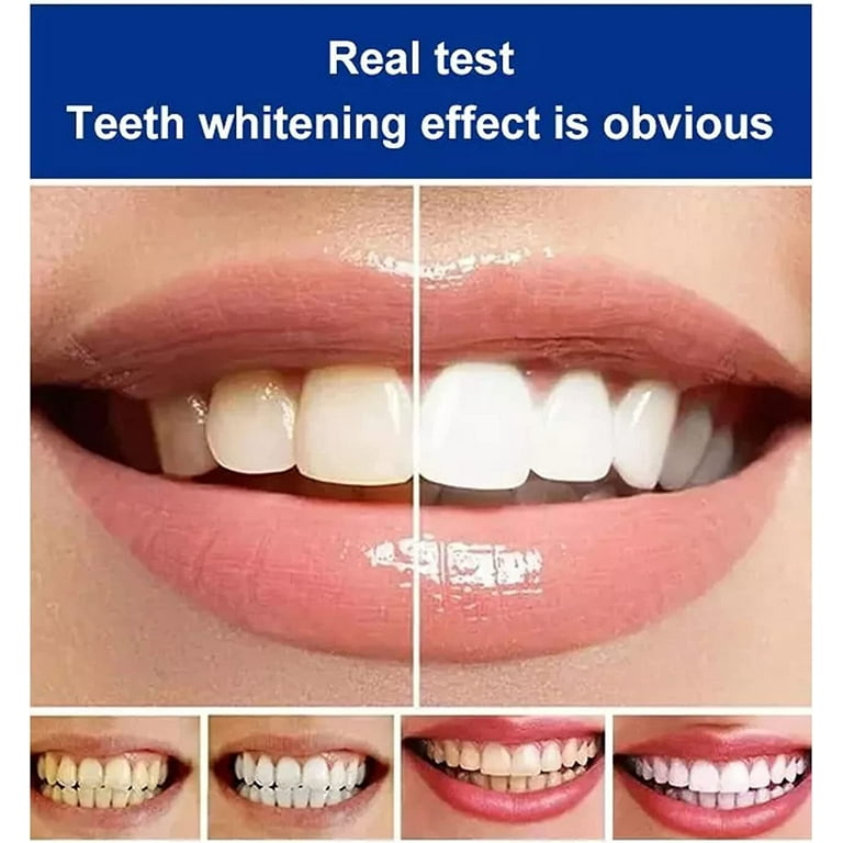 Sp-4 Toothpaste, sp-4 Toothpaste,Teeth Whitener Toothpaste (4PCS