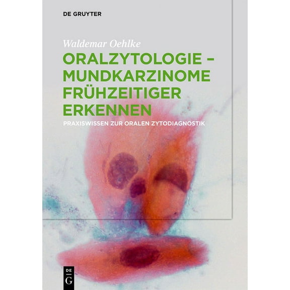 Oralzytologie - Mundkarzinome frühzeitiger erkennen, (Hardcover)