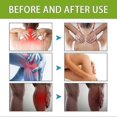 thumbnail image 5 of 1-3x Bee Venom Joint and Bone Therapy Cream,Bee Venom Joint Bone Relief Cream, 5 of 5