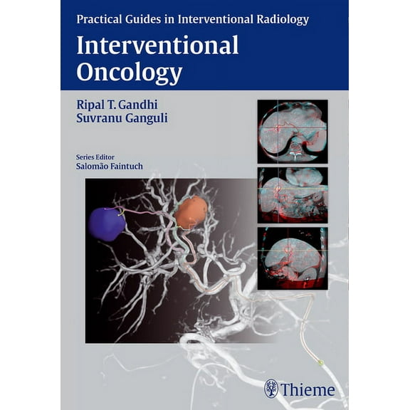 Interventional Oncology (Hardcover)