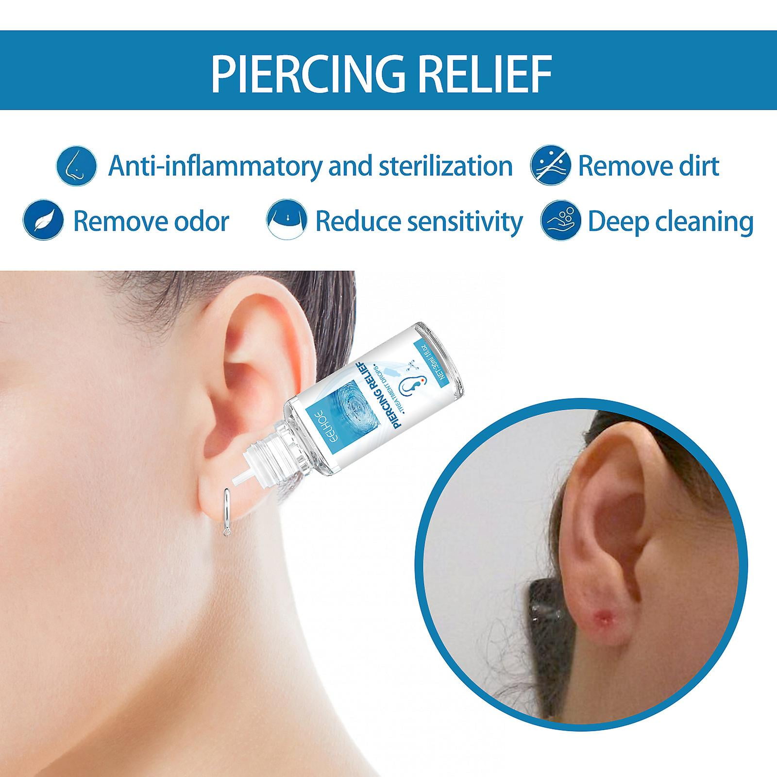 A Keloid How To Remove Bump From Ear Piercing Piercing Bump Relief