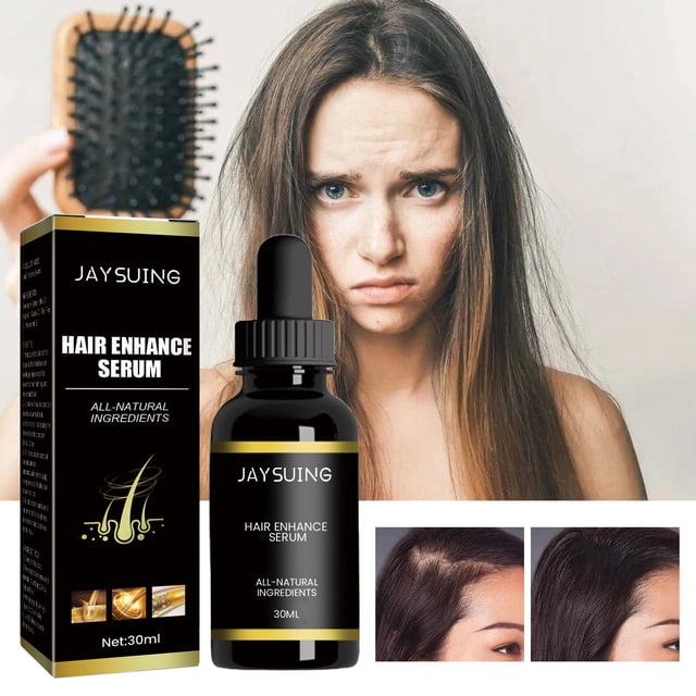 Fórmula de aceites esenciales, sérum para el crecimiento del cabello, aceite, ingredientes, para cabello y cuero cabelludo secos y dañados, cabello fuerte y vital 30 ml. Esencial.