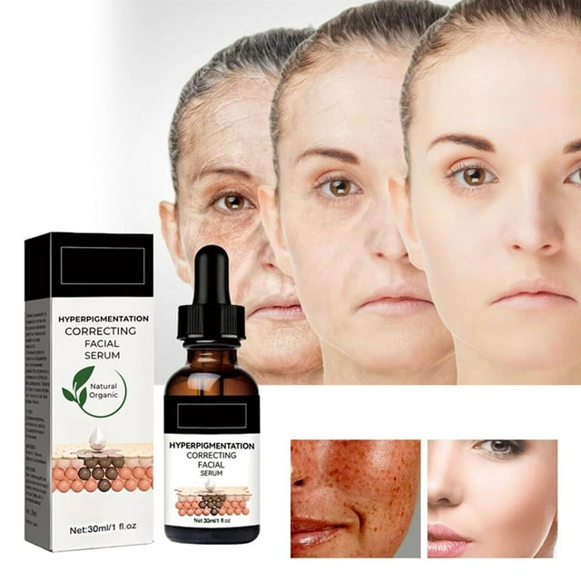 Corrector de manchas oscuras para el rostro, atenúa manchas de la edad, manchas solares, pecas y melasma para una piel más luminosa, hidratada y luminosa - 30 ml / 1 oz