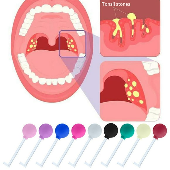 140mm PVC+Glass Tonsil Stone Removal Tool with Right Angle Design - Manual Cleaner for Bad Breath, Lightweight & Travel-Friendly Tonsillectomy Tool